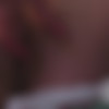 Masturbation